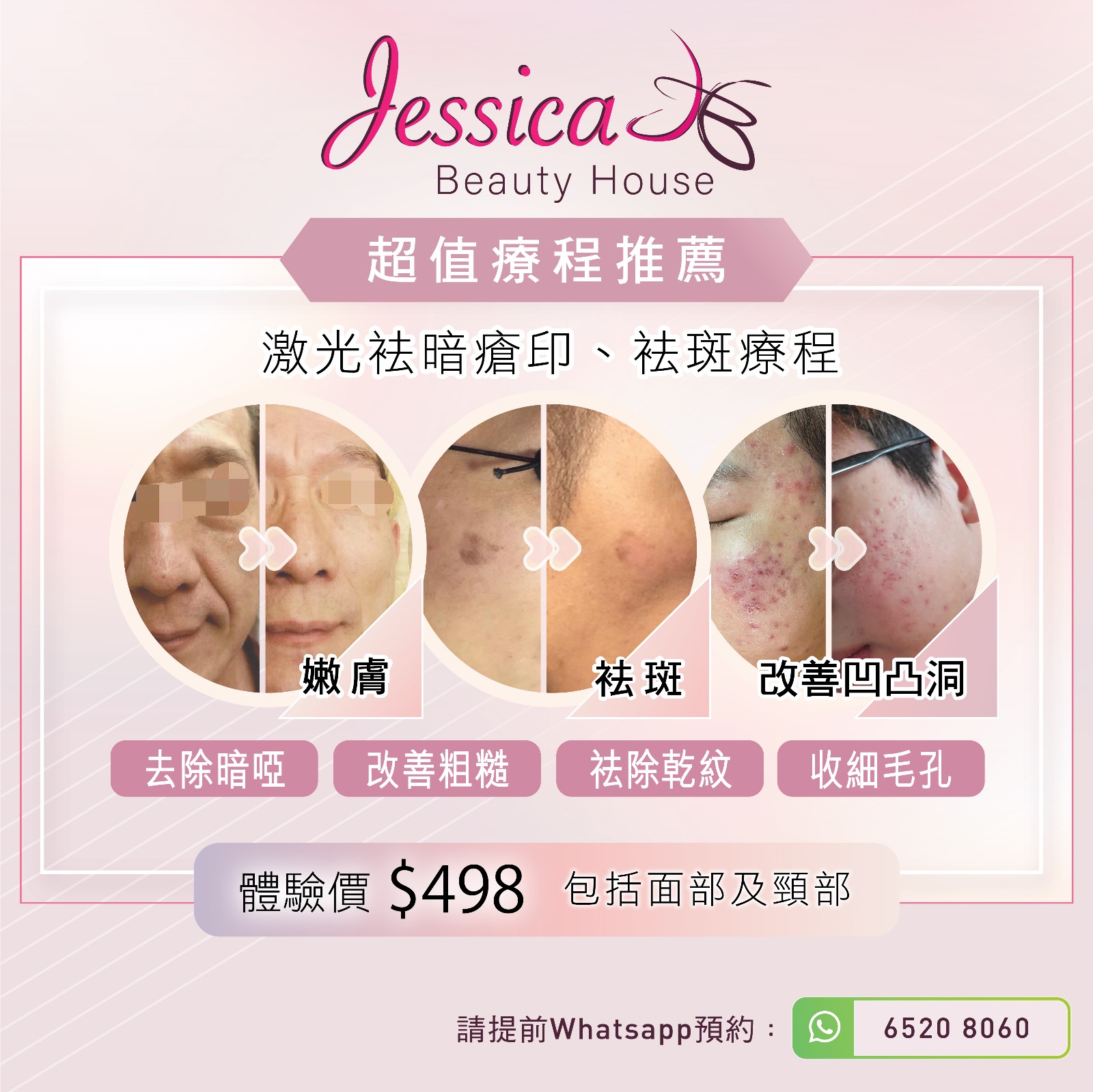 超值療程推薦